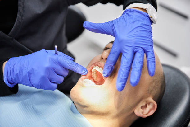 Tooth Infection Emergency Dentist in FL